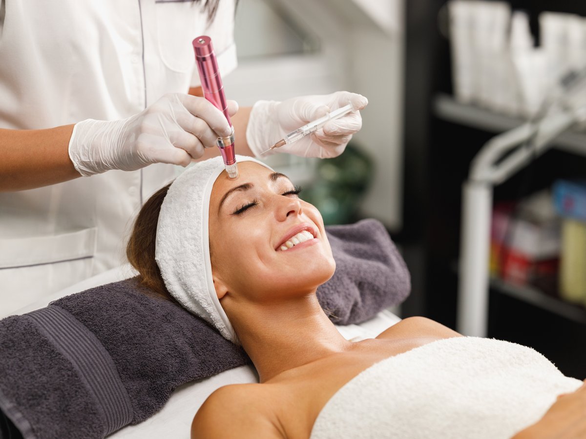Microneedling