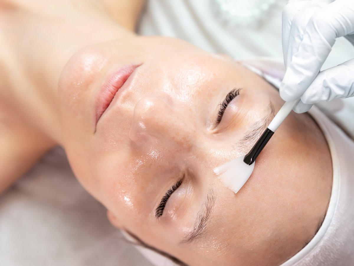 Retinol Peeling