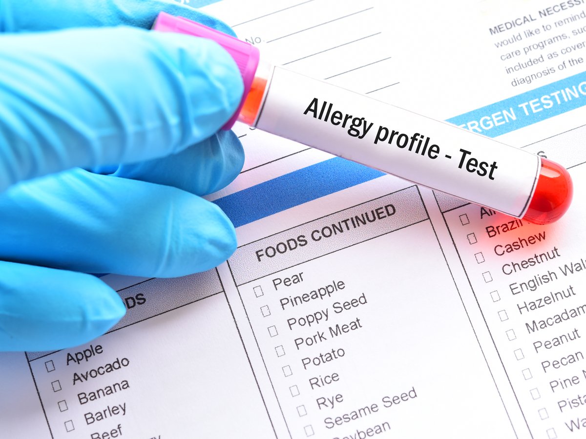 Allergologie